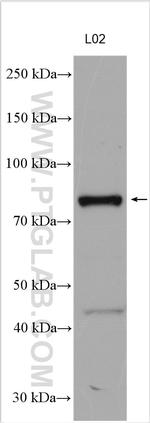 P3H2 Antibody in Western Blot (WB)