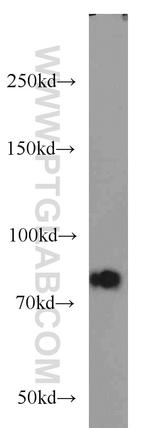 P3H2 Antibody in Western Blot (WB)
