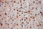 P3H2 Antibody in Immunohistochemistry (Paraffin) (IHC (P))