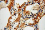 P3H2 Antibody in Immunohistochemistry (Paraffin) (IHC (P))