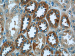 P3H2 Antibody in Immunohistochemistry (Paraffin) (IHC (P))