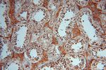 P3H2 Antibody in Immunohistochemistry (Paraffin) (IHC (P))