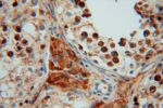 P3H2 Antibody in Immunohistochemistry (Paraffin) (IHC (P))