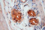 P3H2 Antibody in Immunohistochemistry (Paraffin) (IHC (P))