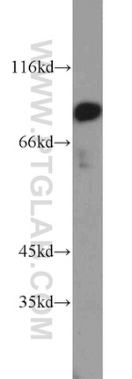 P3H2 Antibody in Western Blot (WB)