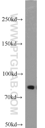 P3H2 Antibody in Western Blot (WB)