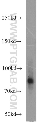 P3H2 Antibody in Western Blot (WB)