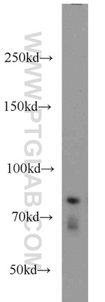 P3H2 Antibody in Western Blot (WB)