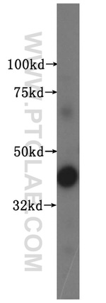 CRTAP Antibody in Western Blot (WB)