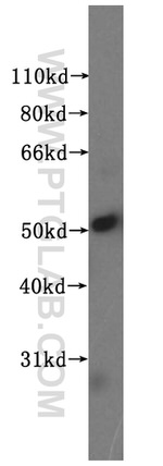 NUF2 Antibody in Western Blot (WB)