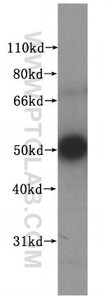 NUF2 Antibody in Western Blot (WB)
