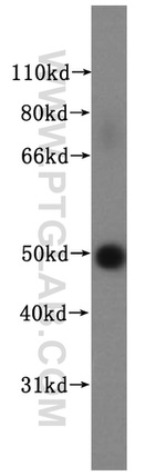 NUF2 Antibody in Western Blot (WB)