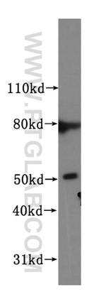 NUF2 Antibody in Western Blot (WB)