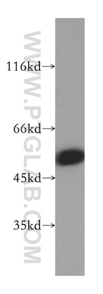 NUF2 Antibody in Western Blot (WB)