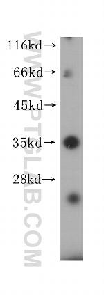 HLA-DRB4 Antibody in Western Blot (WB)