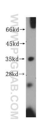 HLA-DRB4 Antibody in Western Blot (WB)