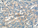 MIA Antibody in Immunohistochemistry (Paraffin) (IHC (P))