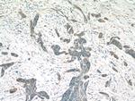 MIA Antibody in Immunohistochemistry (Paraffin) (IHC (P))