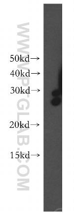 DHRS2 Antibody in Western Blot (WB)