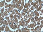 CLPB Antibody in Immunohistochemistry (Paraffin) (IHC (P))