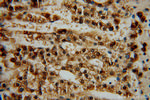 ALDH3B2 Antibody in Immunohistochemistry (Paraffin) (IHC (P))