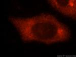 SLC7A4 Antibody in Immunocytochemistry (ICC/IF)