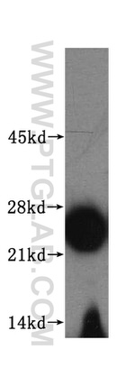 RPL18A Antibody in Western Blot (WB)