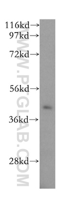 GPN1 Antibody in Western Blot (WB)