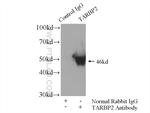 TRBP Antibody in Immunoprecipitation (IP)