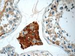 CHMP1A Antibody in Immunohistochemistry (Paraffin) (IHC (P))