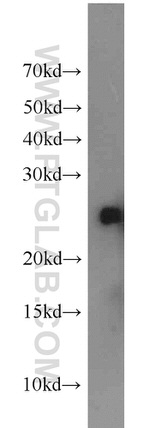 CHMP1A Antibody in Western Blot (WB)