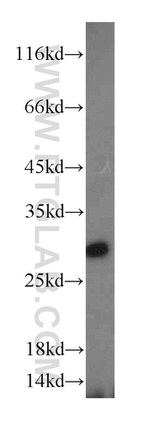 CHMP1A Antibody in Western Blot (WB)