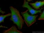NQO2 Antibody in Immunocytochemistry (ICC/IF)
