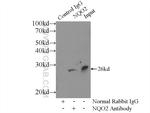NQO2 Antibody in Immunoprecipitation (IP)