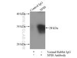 SPIB Antibody in Immunoprecipitation (IP)