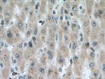ACAD9 Antibody in Immunohistochemistry (Paraffin) (IHC (P))
