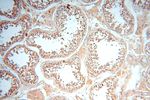 VAC14 Antibody in Immunohistochemistry (Paraffin) (IHC (P))