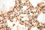 VAC14 Antibody in Immunohistochemistry (Paraffin) (IHC (P))