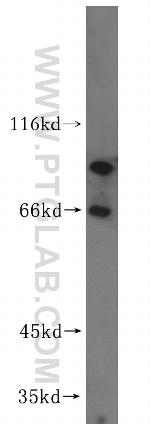 VAC14 Antibody in Western Blot (WB)