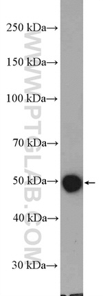 MGAT2 Antibody in Western Blot (WB)