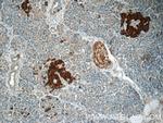 RAB3B Antibody in Immunohistochemistry (Paraffin) (IHC (P))