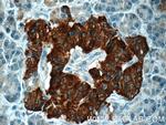 RAB3B Antibody in Immunohistochemistry (Paraffin) (IHC (P))