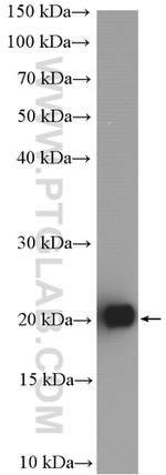 RAB3B Antibody in Western Blot (WB)