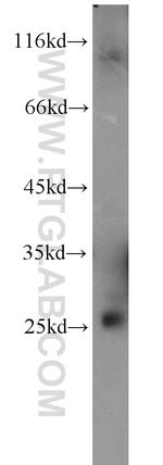 RAB3B Antibody in Western Blot (WB)