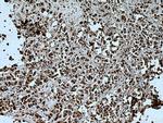 ENY2 Antibody in Immunohistochemistry (Paraffin) (IHC (P))