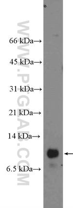 ENY2 Antibody in Western Blot (WB)