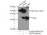 TBCB Antibody in Immunoprecipitation (IP)