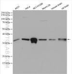 TBCB Antibody in Western Blot (WB)