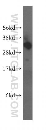 TBCB Antibody in Western Blot (WB)
