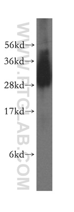 TBCB Antibody in Western Blot (WB)